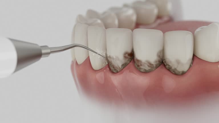 Reliable Root Canal Treatment contractor in Trumbull County County, OH by Dentist Open Now